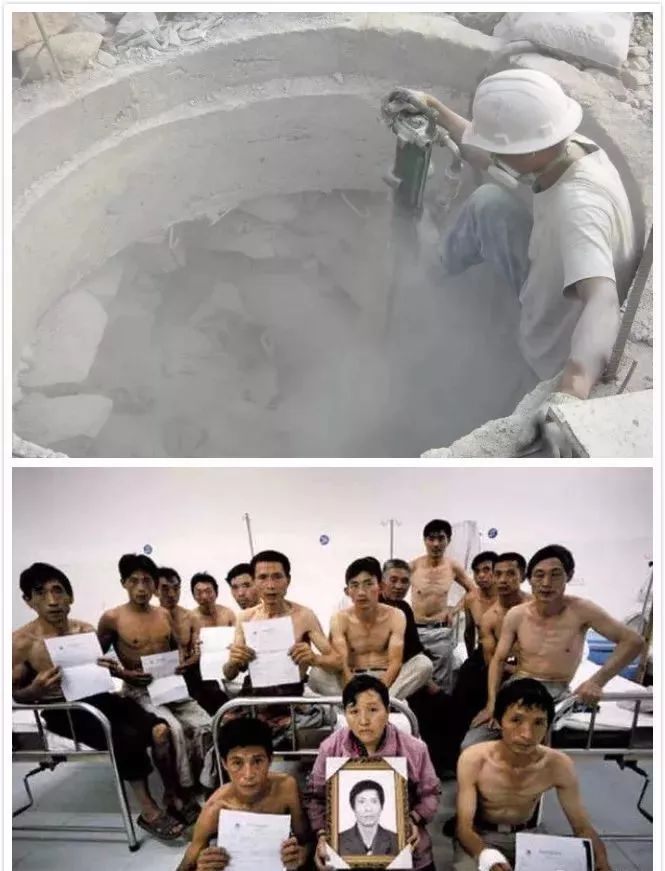尘肺病人.jpeg